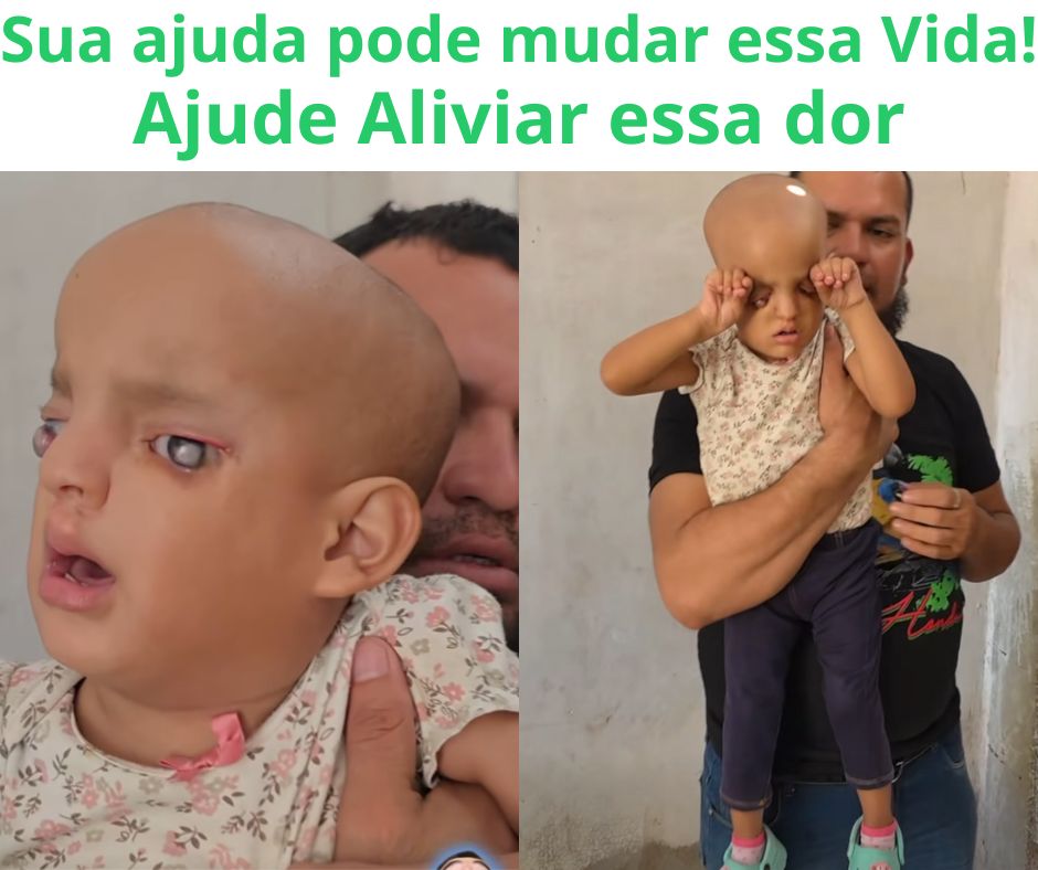 Júlia — campanha para salvar a visão da pequena